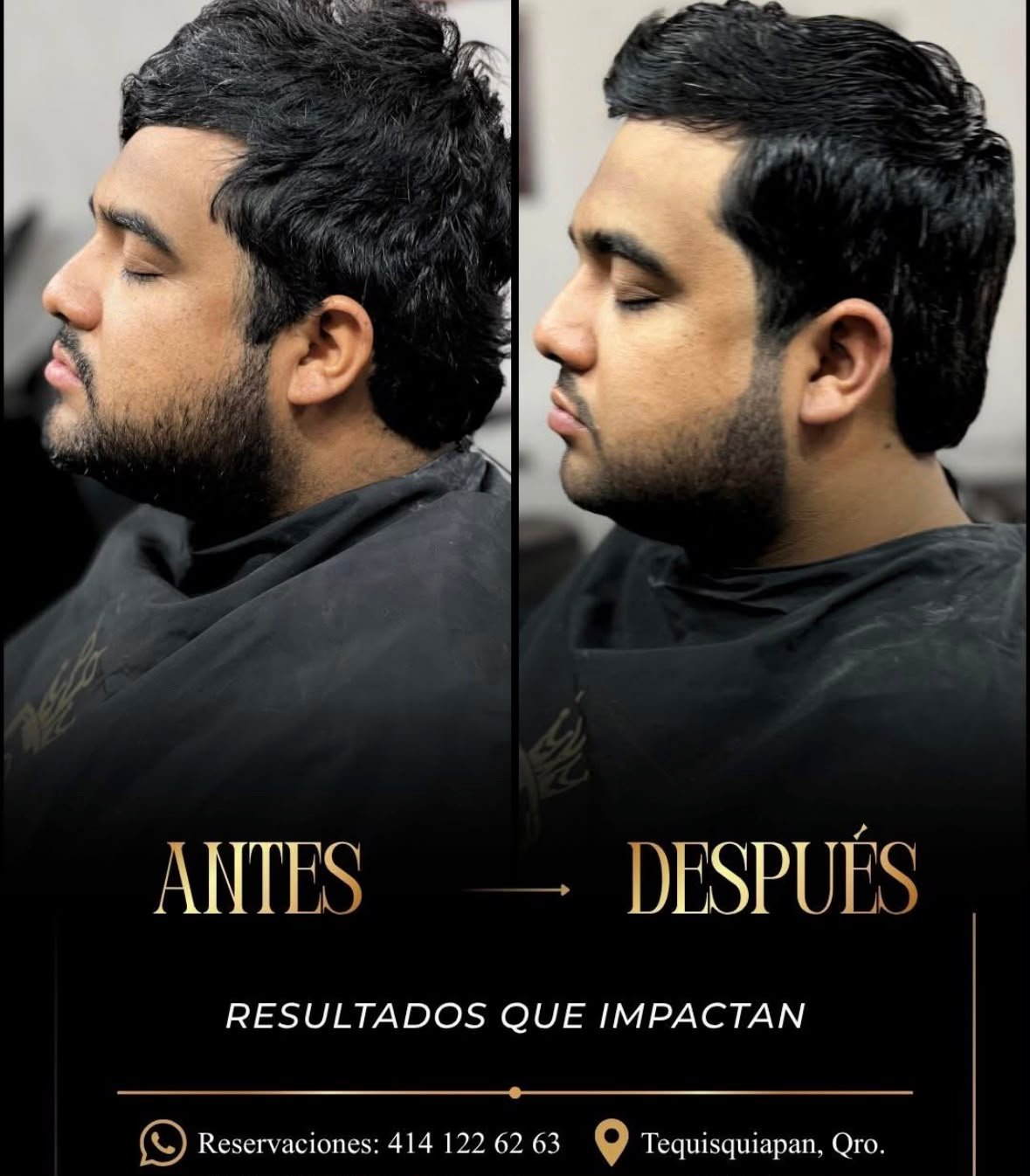 Antes y después - resultados Gran Barón